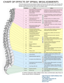 Effects Of Spinal Misalignments Chart